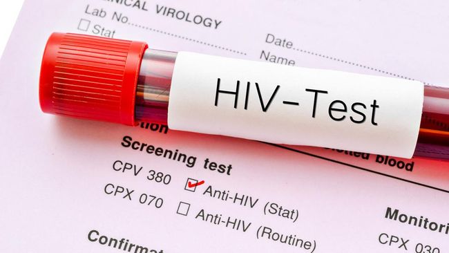 11 Provinsi Ini Jadi Penyumbang Terbesar Kasus HIV di Indonesia